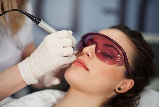 Biorevitalizzazione laser