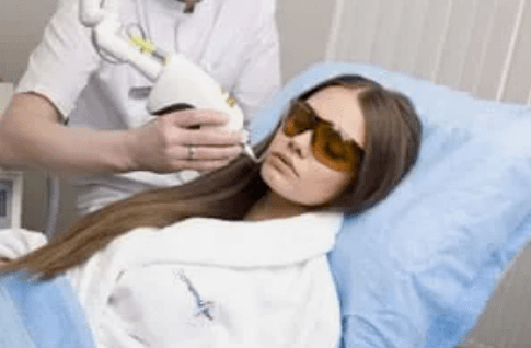 ringiovanimento laser frazionato